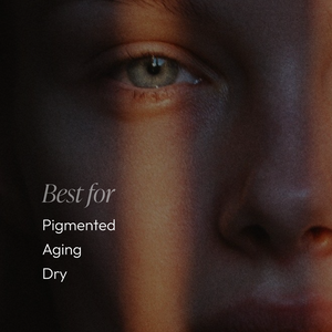 Close-up of a person’s face with soft natural light highlighting the skin, accompanied by text stating "Best for Pigmented, Aging, Dry" conditions, promoting Amandola Milk Cleanser | Circadia skincare.