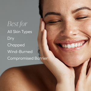 Close-up of a smiling woman with clear, glowing skin resting her face on her hand, alongside text listing skin types and conditions best suited for Hydralox | Circadia including all skin types, dry, chapped, wind-burned, and compromised barrier.