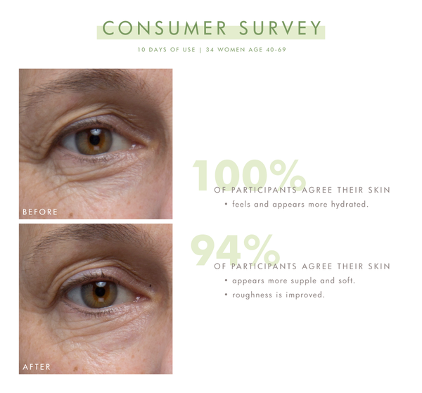 Close-up before and after photos of a woman's eye area showing improved skin hydration, suppleness, and reduced roughness after 10 days of using Lustre Rose™ Serum-in-Oil | Farmhouse Fresh.