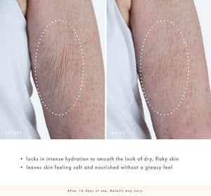Comparison of arm skin before and after using Pink Moon Shea Butter Hand Cream | FarmHouse Fresh, showing visibly smoother, hydrated, and nourished skin without dryness or flakiness.